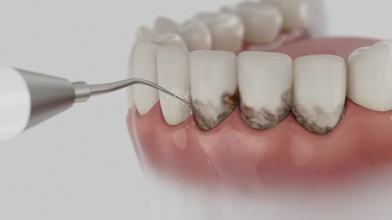 Trusted Emergency Dentist service in Clarksville, AR - Dentist Open Now